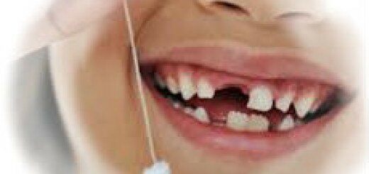 Сонник - сломанный зуб,зубы выпали