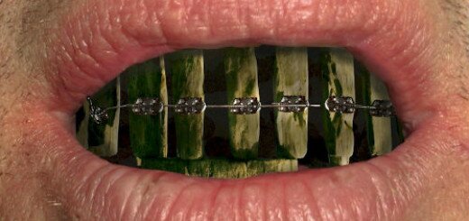 к чему снятся черные зубы во рту